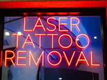 From Regret to Renewal: Emotional Healing Through Tattoo Removal