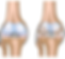 Knee Before and After Hyaluron2Go