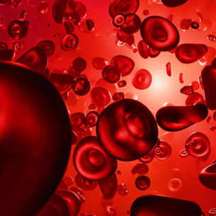 Myelodysplastic Syndrome (MDS): Blood Cancer Symptoms