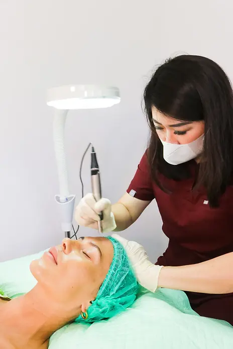 Microneedling.webp