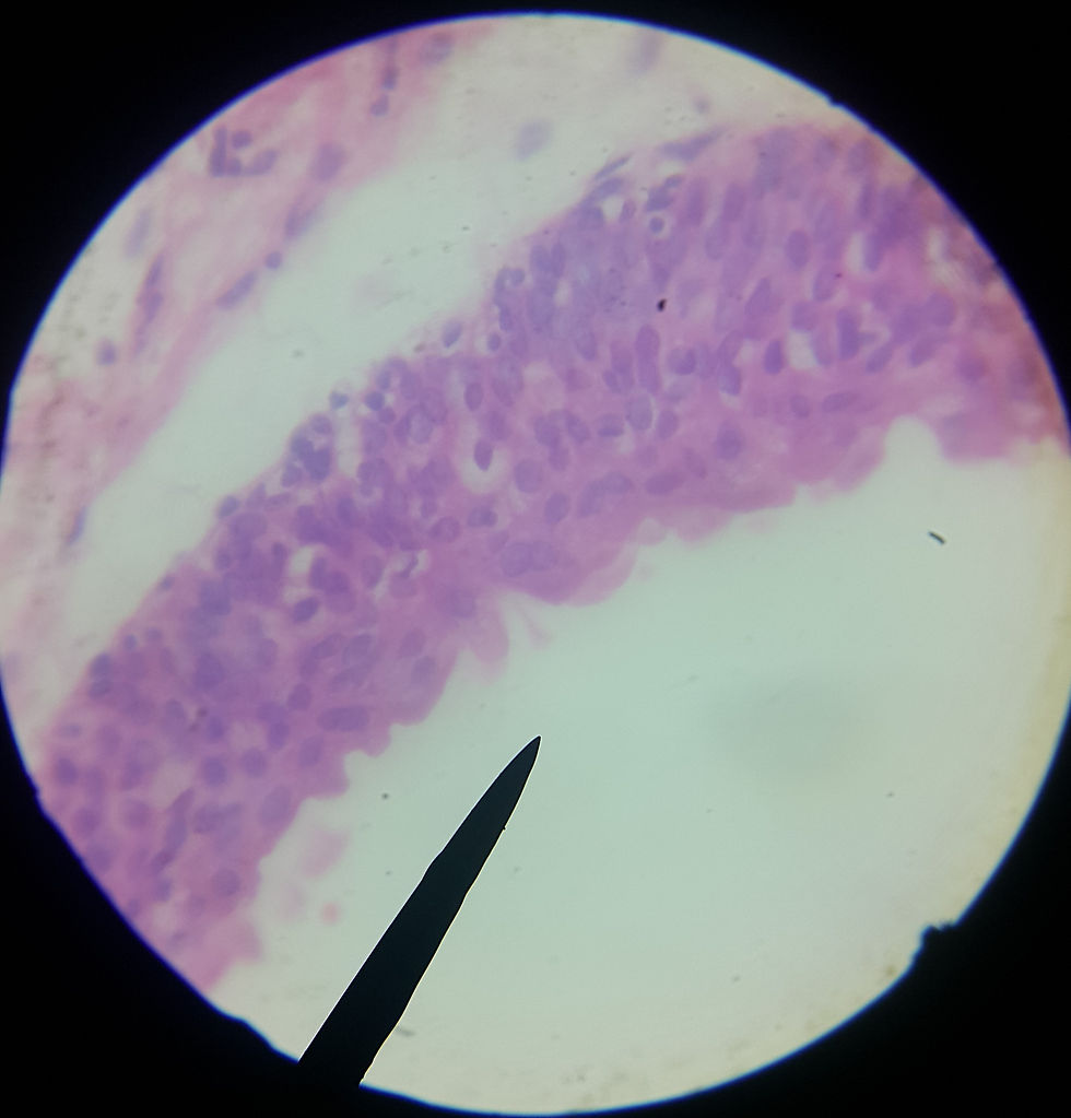 Ureter [40x]