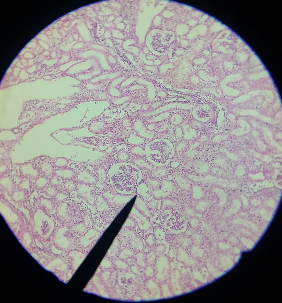 Capa parietal de Bowman [10x]