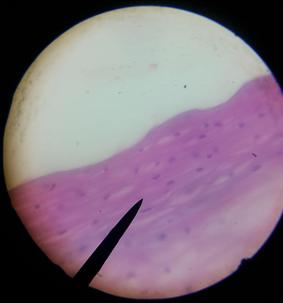 Endocervix [40x]