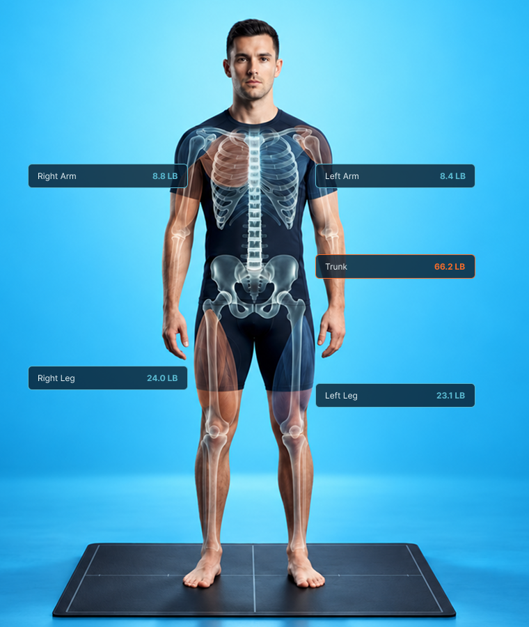 DEXA scan showing regional lean mass and body symmetry measurements