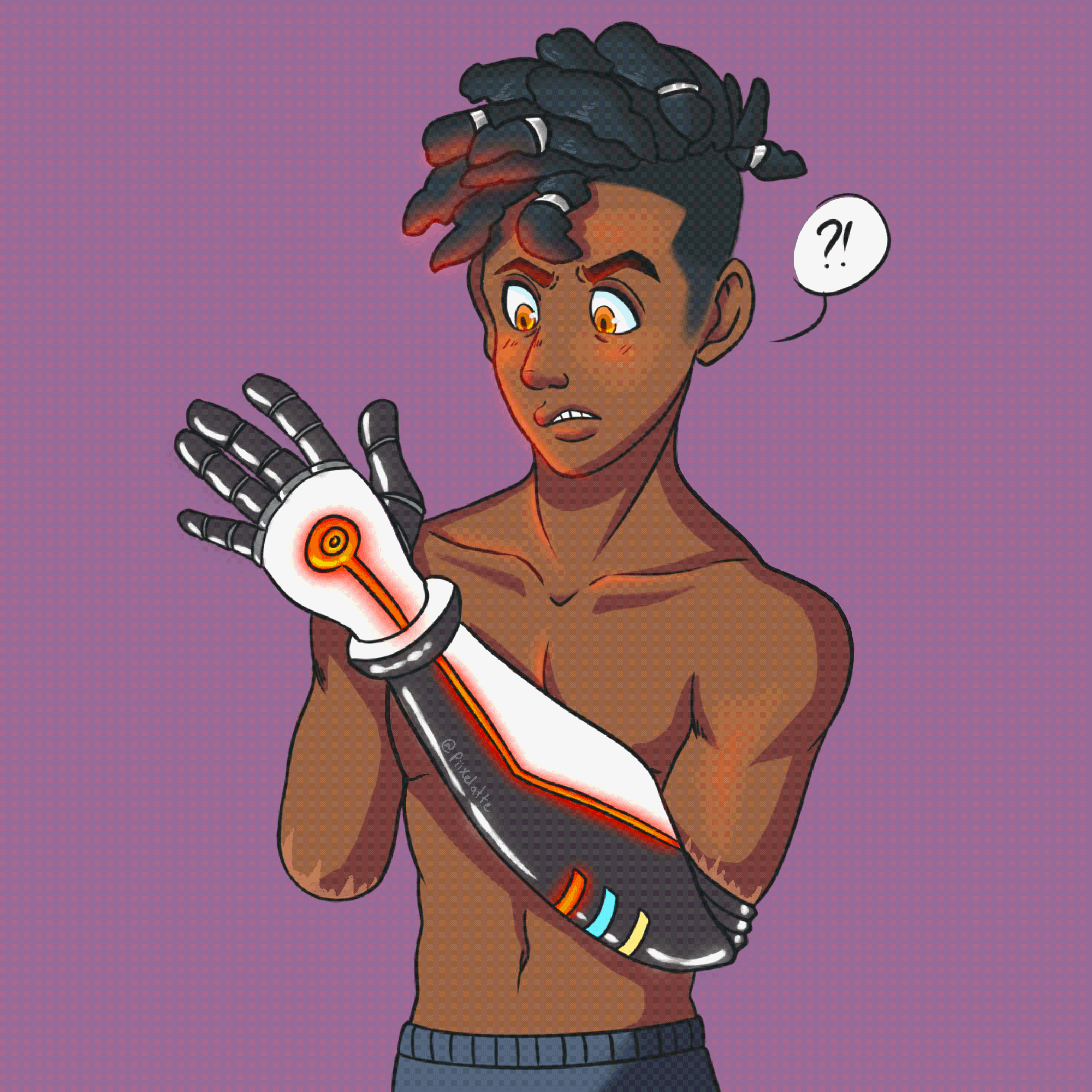 Aster's first bionic arm