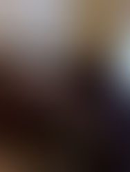 Лестница на тетивах с поворотом на 180 градусов, угловыми ступенями, кованными балясинами, обшивкой 