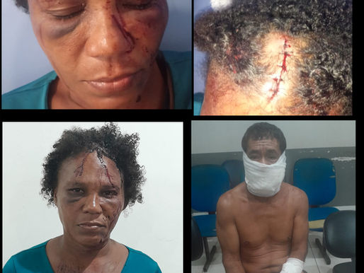 Tentativa de Feminicídio é registrada no povoado São Pedro em Santa Helena