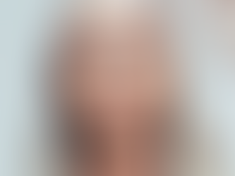 Discover premium Botox & Dermal Fillers for face and body at Highly Cosmetics London — clinics in Central London, North London & Brentwood.