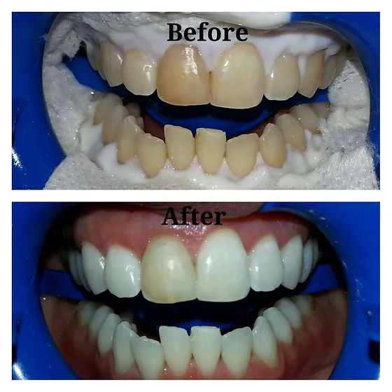 Dental Clinic In Maadi Egypt Shalash Dental Center I had a great dental experience here in hollywood smile dental clinic. dental clinic in maadi egypt