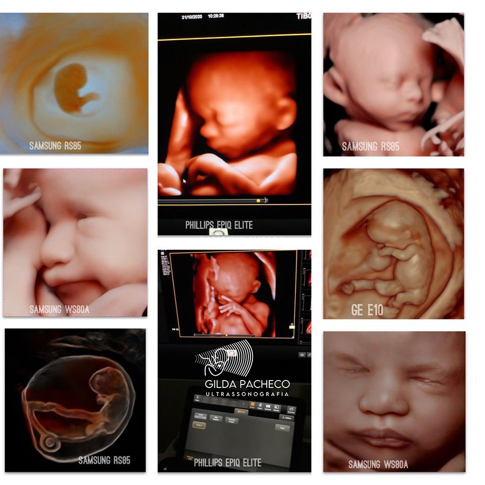 Um tributo a sir. Albert William Liley (in Memorian)