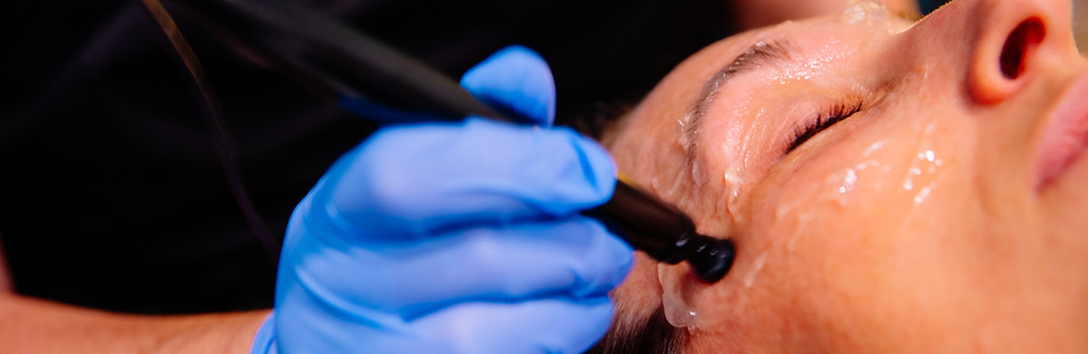 ThermiSmooth Procedure