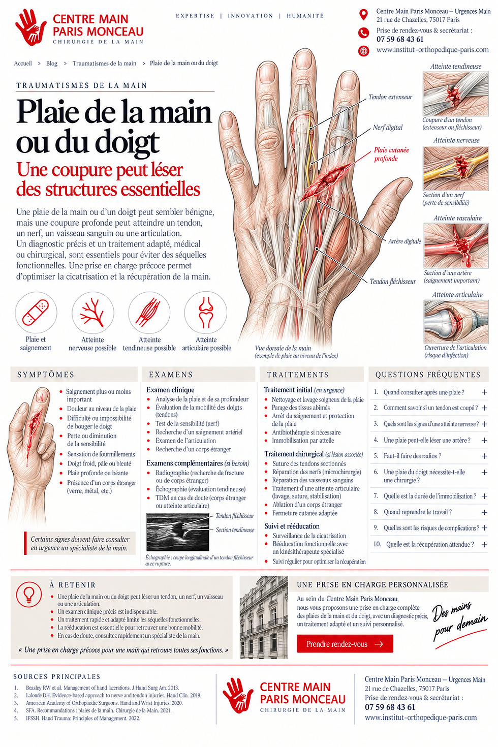 Plaie de la main ou du doigt : atteintes tendineuses, nerveuses, vasculaires et prise en charge en urgence