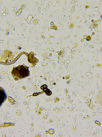 fungal strands and a fungal hyphae in compost