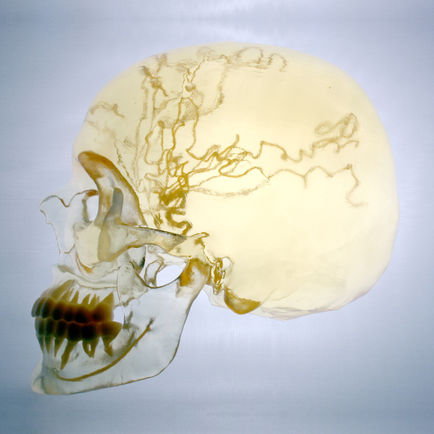 Photo_clear_skull