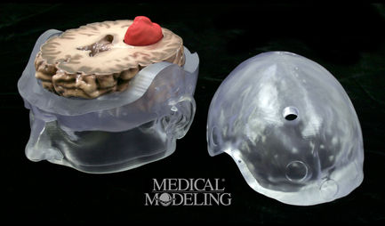 Medtronic