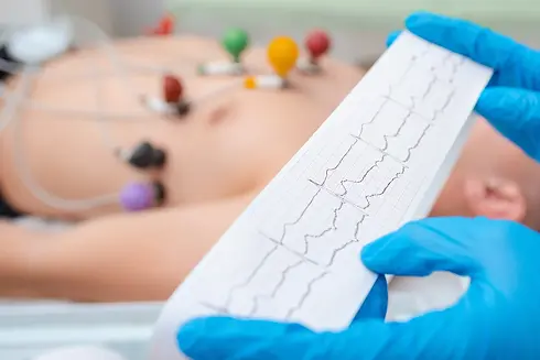 Eletrocardiograma.JPEG