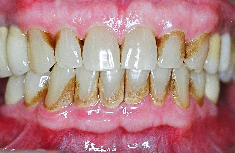 Periodontia