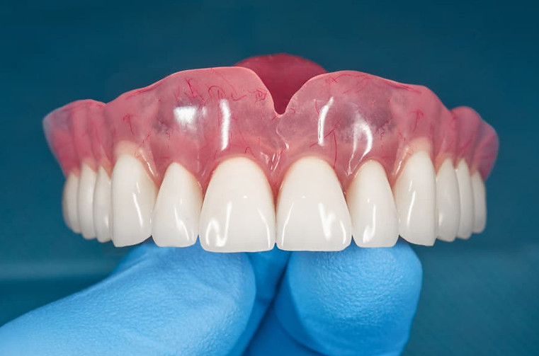 protese-dentaria