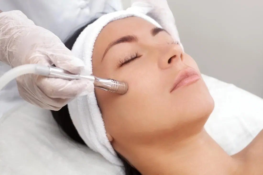 microdermabrasion facial