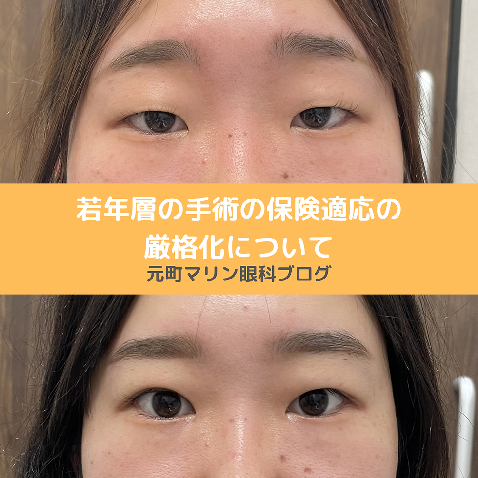 若年層(10代〜30代)の眼瞼下垂手術、保険診療の基準が厳格化している理由と選択肢