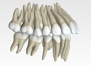 Arena Alicia Pré-traitement.png