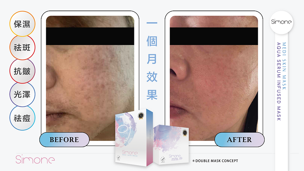 縮圖：袪斑面膜