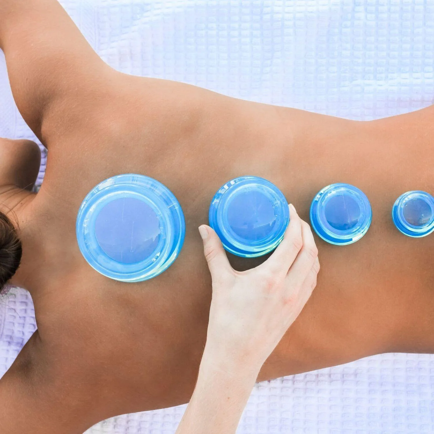 cupping