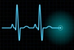 The Role of an EKG Technician: Understanding Their Vital Contribution to Healthcare