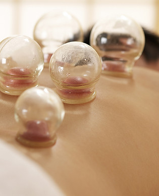 cupping-therapy.jpg