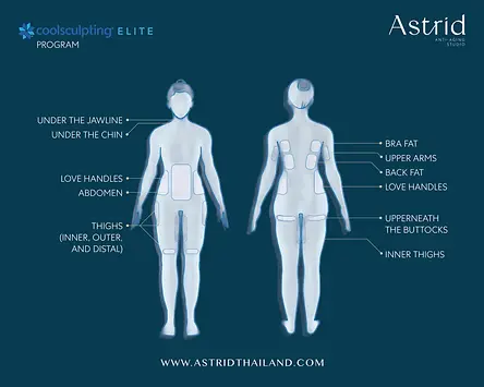 CoolSculpting_ Treatment Areas-min.webp