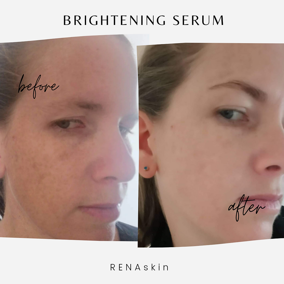 Thumbnail: Brightening Serum