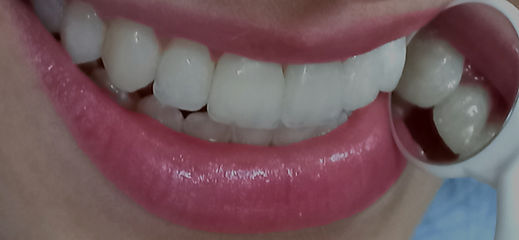 Sorriso HD_edited_edited_edited_edited.jpg
