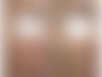 【レーザーを繰り返しても変化を感じられなかった方へ】