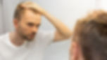 man-examining-his-hair-loss-in-mirror-2026-03-16-06-07-25-utc.jpg