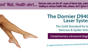 Don't wait to take care of varicose veins!