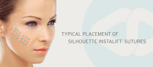 InstaLift - A minimally invasive procedure providing instant results. Introducing suspension sutures