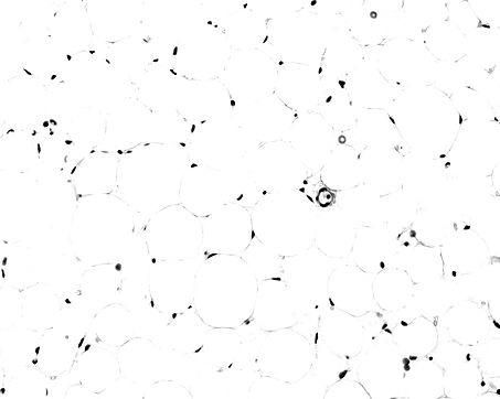 White adipose tissue stained with HE. Adipocytes (fat cells) contains a large lipid drople
