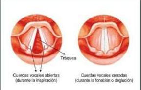 260px-Cuerdas_vocales.jpg