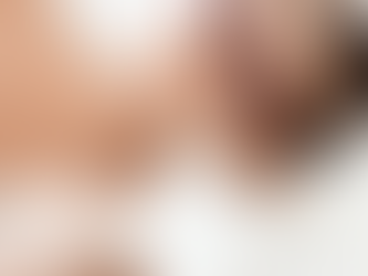 The Advantages of Male Laser Hair Removal Personal Care