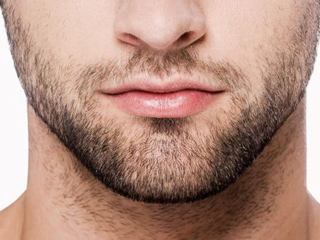 Beard Hair Transplants: Shaping the Future of Masculine Aesthetics
