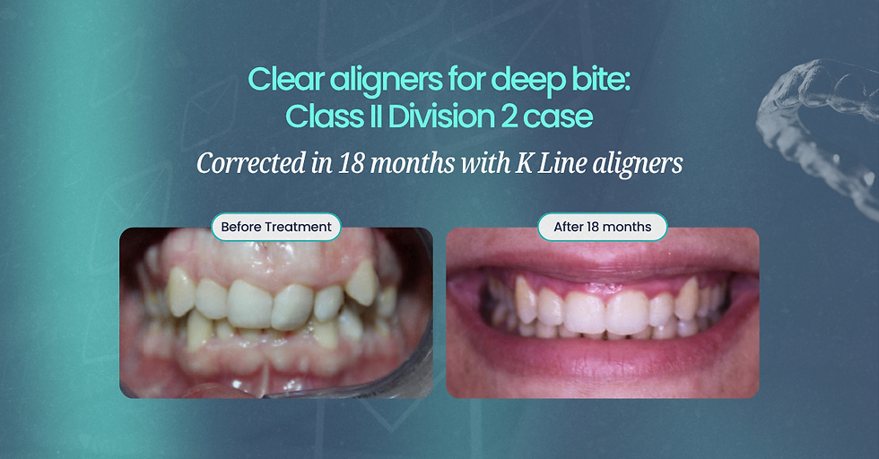 Clear aligners for deep bite before and after: Class II Division 2 case corrected in 18 months with K Line aligners