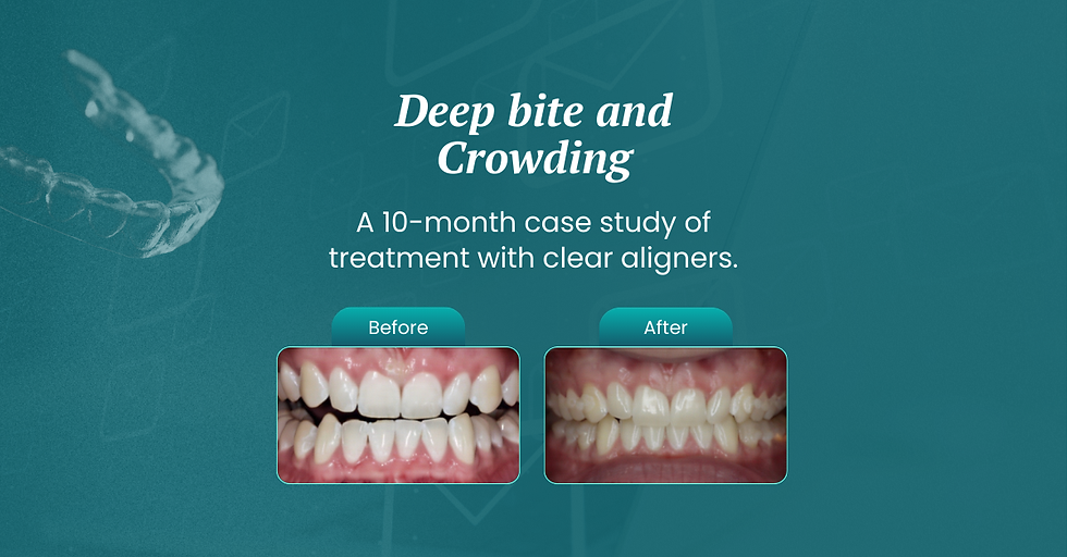 A teal graphic showing information about a 10‑month clear aligner case study for deep bite and crowding, with two blurred before‑and‑after dental photos and a note that a new article is live on the Knowledge Center.