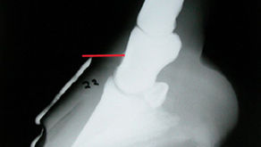 How to Measure the Coronary Band/Extensor Process (CE)