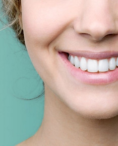 Lente-de-contato-dental-valor.jpg