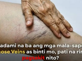 Chronic Venous Disease