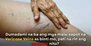 Chronic Venous Disease