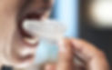 snoremate-instructions-mouthpiece.jpg