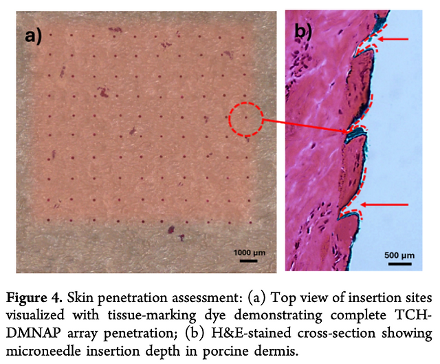 Effervescent-Assisted Dissolving Microneedle Patches