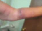 One week today. Swelling is going down, as is the discoloration. That's gonna leave a mark...