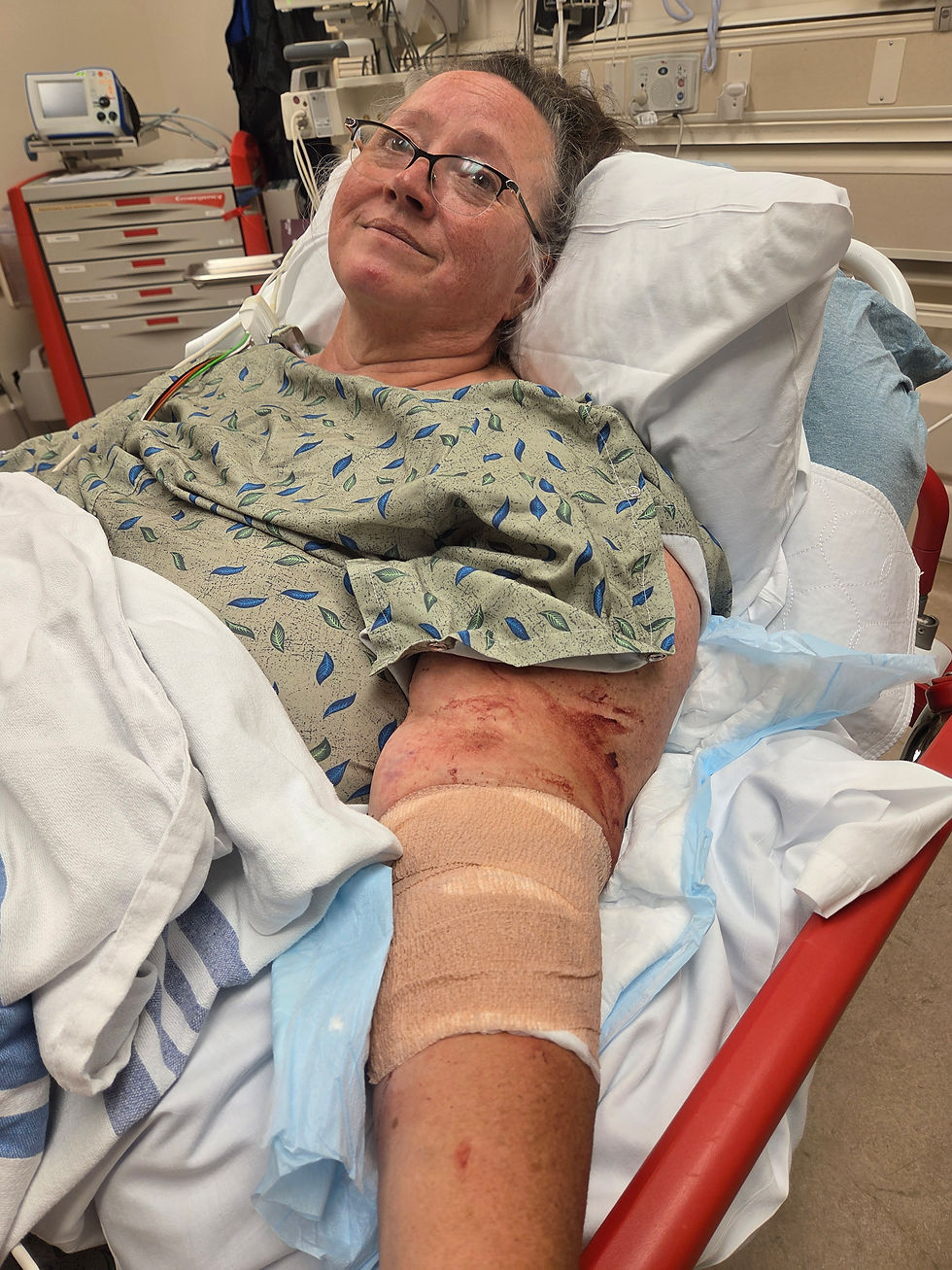 Still wrapped from the medics.